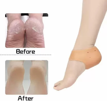 Silicone Gel Heel Pad Socks